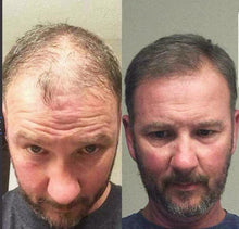 Cargar imagen en el visor de la galería, Minoxidil Espuma Kirkland 5% Crece Barba Cabello y Cejas