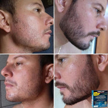 Cargar imagen en el visor de la galería, Minoxidil Liquido Kirkland 5% Crece Barba Cabello y Cejas